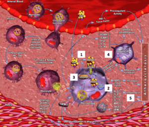 Atherosclerose